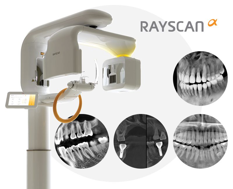 Implant Solutions RayScan
