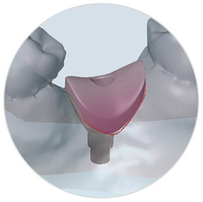 is_tissueformer_caddesign