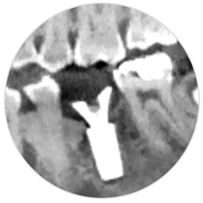 is_tissueformer_finalcontour