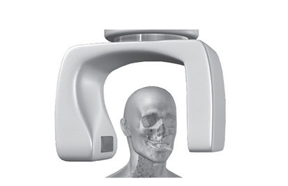 is_non edentulous_scansolutions_step4 Implant Solutions Non Edentulous Take CT Scan