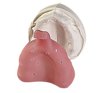 is_scansolutions_Fully Edentulous_Method2_Step1 Implant Solutions Fully Edentulous Method 2 Impression