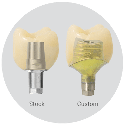 Stock vs. Custom web image